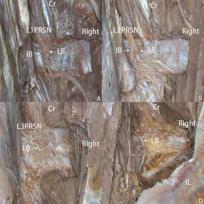 Anatomical study and clinical significance of the posterior ramus of the spinal nerve of the lumbar spine